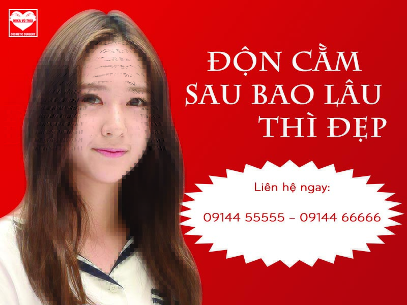 độn cằm sau bao lâu thì đẹp