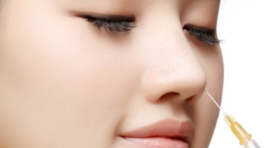 Nâng mũi không cần phẫu thuật chỉ thích hợp với 1 số trường hợp