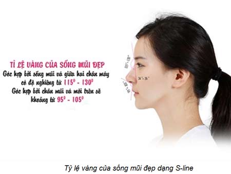 Nâng mũi Sline là kỹ thuật nâng mũi hiện đại tại Việt Nam